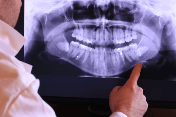 Best Emergency Dentist for Knocked-Out Tooth in Valley Mills, TX